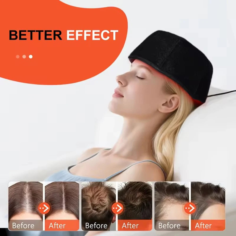 660nm 850nm Red & Infrared Light Hair Growth Cap, USB Charging Red Light Therapy Device Hair Loss Treatment Hair Regrowth Helmet